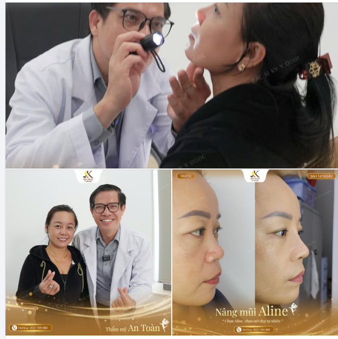 MỘT CA MŨI – MỘT HÀNH TRÌNH THAY ĐỔI