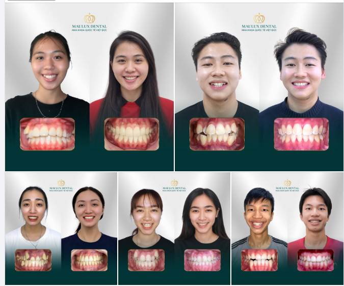 TỰ DO NỤ CƯỜI - TỰ TIN ĐÓN NĂM HỌC MỚI!