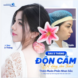 KẾT QUẢ SAU 2 THÁNG ĐỘN CẰM