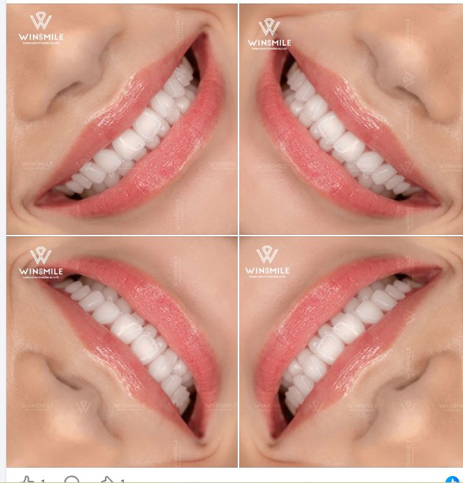 Có một kiểu đẹp không đến từ sự hoàn hảo tuyệt đối, mà đến từ cảm giác vừa vặn – vừa vặn với gương mặt, với nụ cười, với chính con người mình
