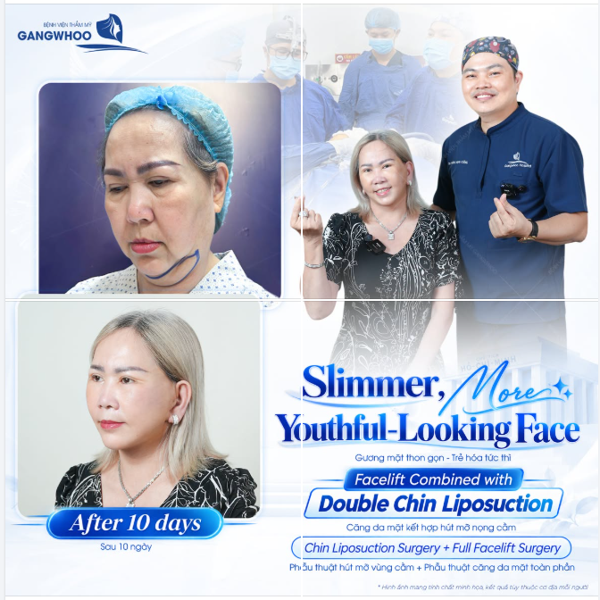 GƯƠNG MẶT THON GỌN - TRẺ TRUNG