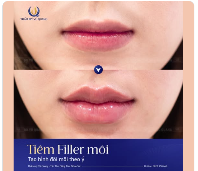 30 PHÚT CHO MỘT ĐÔI MÔI HOÀN HẢO