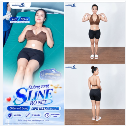 ĐƯỜNG CONG S-LINE RÕ NÉT
