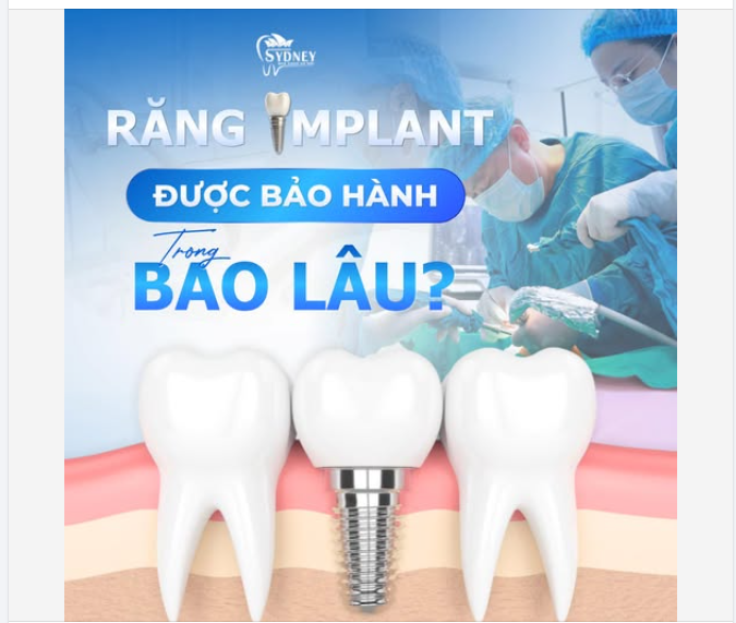 RĂNG IMPLANT ĐƯỢC BẢO HÀNH TRONG BAO LÂU?