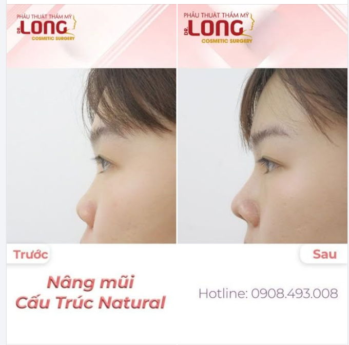 BIẾT TIN GÌ CHƯA ?  Nếu bạn chưa biết thì bây giờ biết vẫn còn kịp đấy.