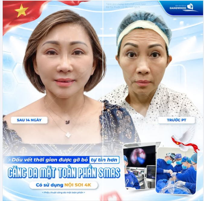 DẤU VẾT THỜI GIAN ĐƯỢC GỠ BỎ TỰ TIN HƠN
