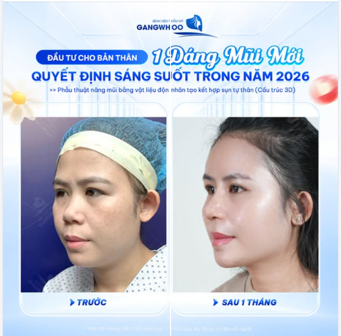 ĐẦU TƯ CHO BẢN THÂN 1 DÁNG MŨI MỚI