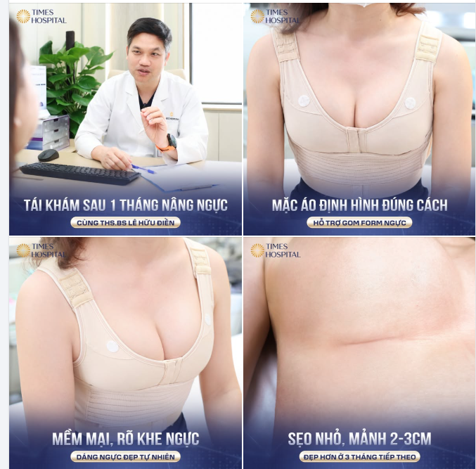 KẾT QUẢ TÁI KHÁM 1 THÁNG SAU NÂNG NGỰC