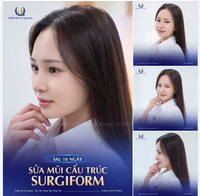 10 NGÀY NÂNG MŨI - HÓA "CÔ TẤM" XINH ĐẸP