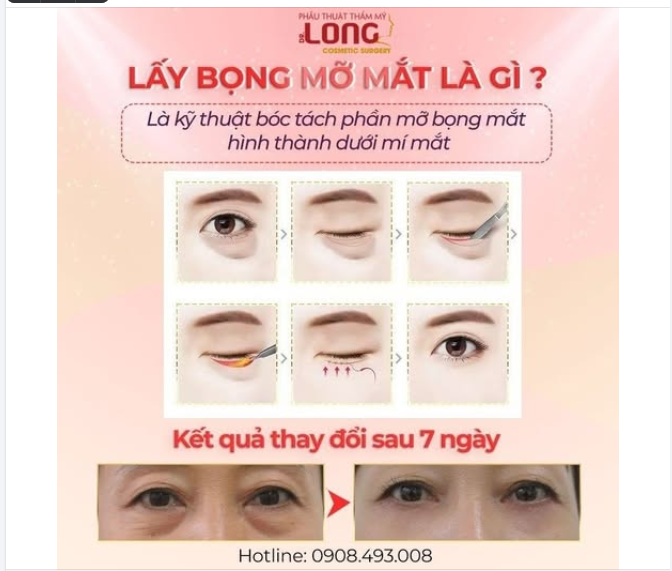 Làm ngay điều sau nếu muốn khuôn mặt trẻ ra, tràn đầy sức sống