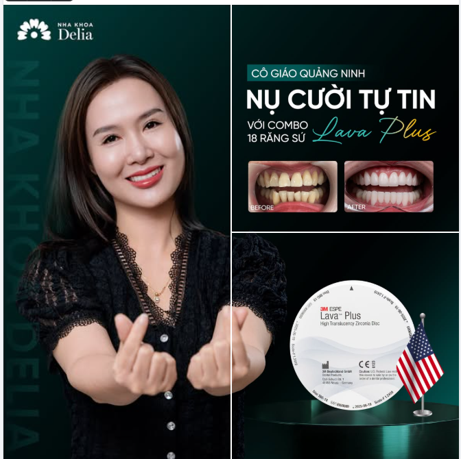 Cô giáo ở Quảng Ninh: Làm 18 răng sứ Lava Plus nụ cười thăng hạng