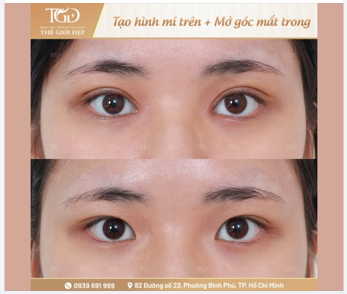 Một combo hai điểm chạm – Đôi mắt hài hòa, rạng rỡ hơn