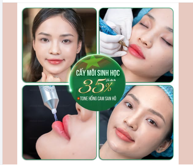 CHÀO LỄ 2/9: CẤY MÔI SINH HỌC CĂNG MỌNG - ƯU ĐÃI TỚI 35%