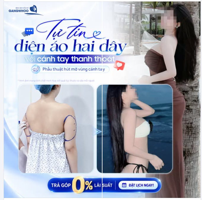 TỰ TIN DIỆN ÁO HAI DÂY VỚI CÁNH TAY THANH THOÁT