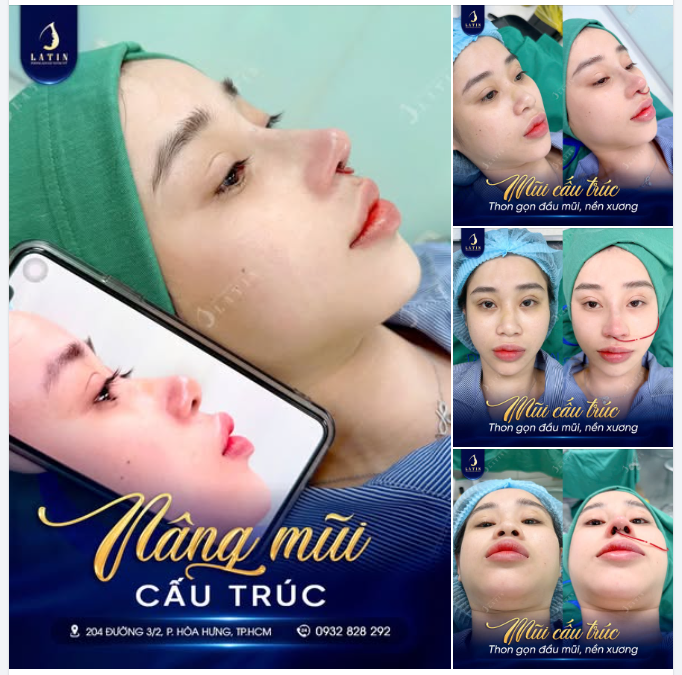 BÍ QUYẾT CHO GÓC NGHIÊNG SẮC SẢO VÀ THẦN THÁI CUỐN HÚT