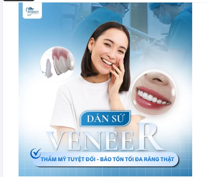 DÁN SỨ VENEER: THẨM MỸ TUYỆT ĐỐI – BẢO TỒN TỐI ĐA RĂNG THẬT