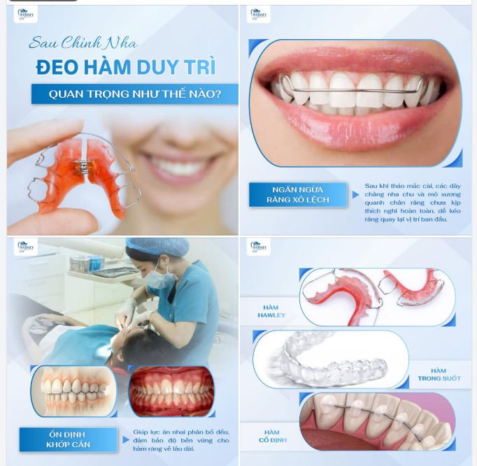SAU CHỈNH NHA ĐEO HÀM DUY TRÌ QUAN TRỌNG NHƯ THẾ NÀO?