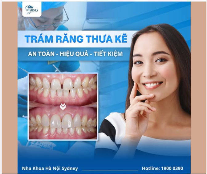 TRÁM RĂNG THƯA KẼ – AN TOÀN, HIỆU QUẢ, TIẾT KIỆM