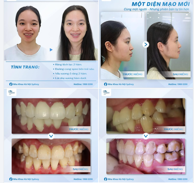 CHÚC MỪNG THÁO NIỀNG: KH HÀ GIANG