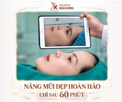 NÂNG MŨI ĐẸP HOÀN HẢO CHỈ SAU 60 PHÚT CÙNG Bs QUANG VTM XUÂN HƯƠNG