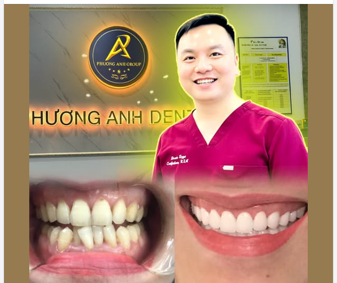 Làm cầu răng sứ có gây hôi miệng không ?