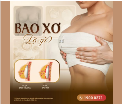 BAO XƠ NGỰC LÀ GÌ? ĐIỀU CHỊ EM NÊN BIẾT TRƯỚC KHI NÂNG NGỰC
