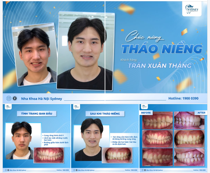 CHÚC MỪNG THÁO NIỀNG KH. XUÂN THẮNG