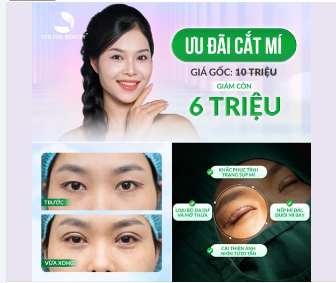 Bạn muốn đôi mắt rõ nét, tươi tắn hơn nhưng vẫn băn khoăn về chi phí và dáng mí phù hợp?