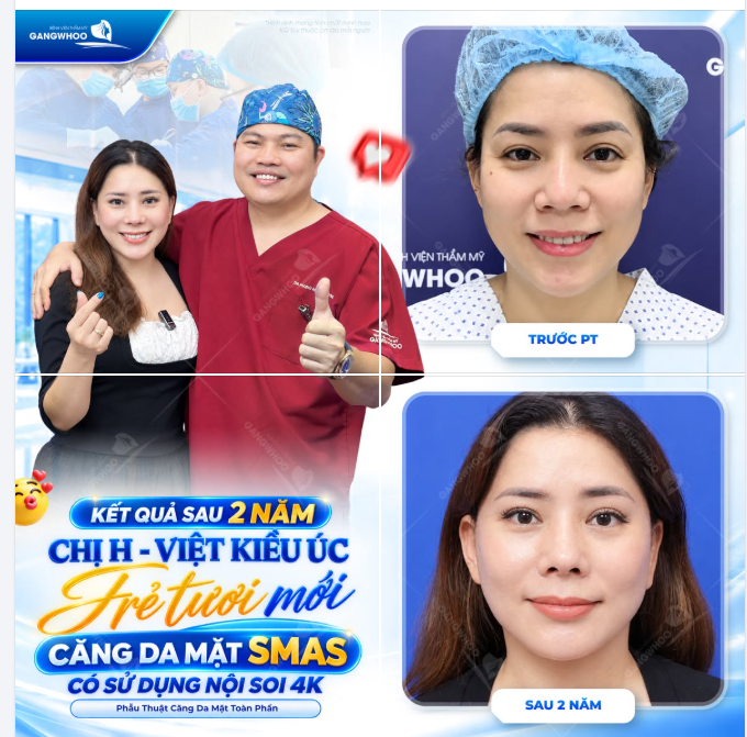 KẾT QUẢ SAU 2 NĂM CHỊ H - VIỆT KIỀU ÚC TRẺ TƯƠI MỚI