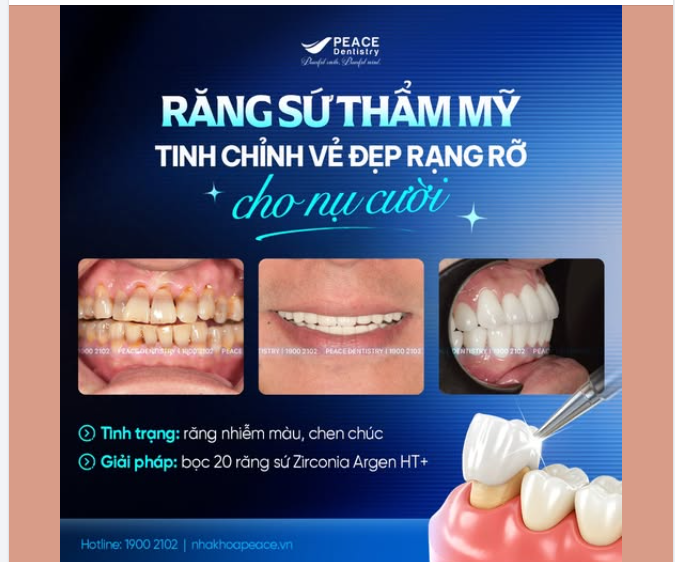 KHI TỪNG ĐƯỜNG NÉT TRÊN GƯƠNG MẶT ĐƯỢC TÔ ĐIỂM BỞI MỘT NỤ CƯỜI HOÀN HẢO