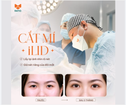 Lấy lại ánh nhìn rõ nét, vẫn giữ nét riêng của đôi mắt