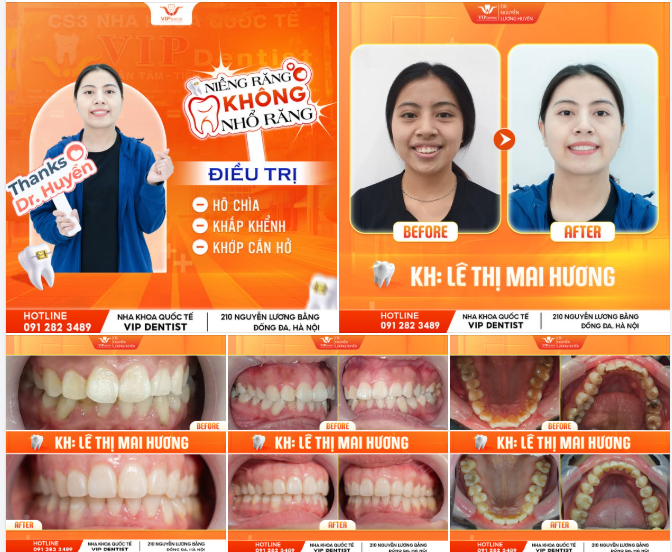 RẠNG RỠ NỤ CƯỜI XINH NGÀY THÁO NIỀNG