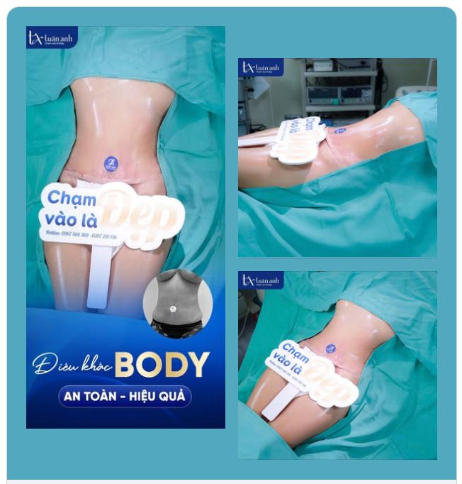 VÌ SAO ĐIÊU KHẮC BODY LẠI LÀ LỰA CHỌN ƯU TIÊN CỦA CHỊ EM PHỤ NỮ?