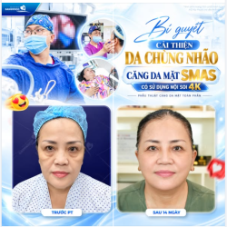 BÍ QUYẾT CẢI THIỆN DA CHÙNG NHÃO