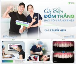 1 BUỔI HẸN CẢI THIỆN ĐỐM TRẮNG TRÊN RĂNG CHO NỤ CƯỜI THÊM TỰ TIN