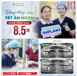 TRỒNG IMPLANT TRƯỚC TẾT - QUYẾT ĐỊNH MANG LẠI NHIỀU LỢI ÍCH