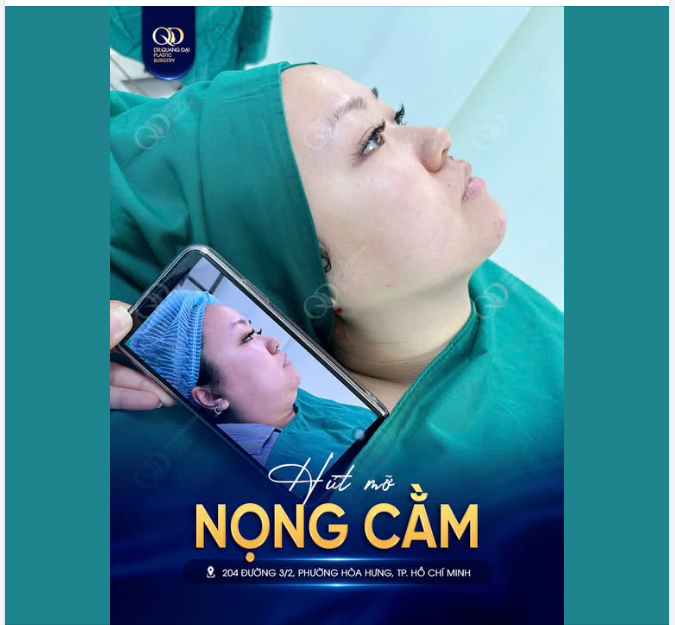 MUỐN GỌN NỌNG CẰM, NHƯNG VẪN NGẠI CAN THIỆP?