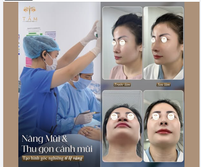 NÂNG THU GỌN CÁNH MŨI ĐÃ THAY ĐỔI CHỊ ĐẸP NHÀ TẤM NHƯ THẾ NÀO?