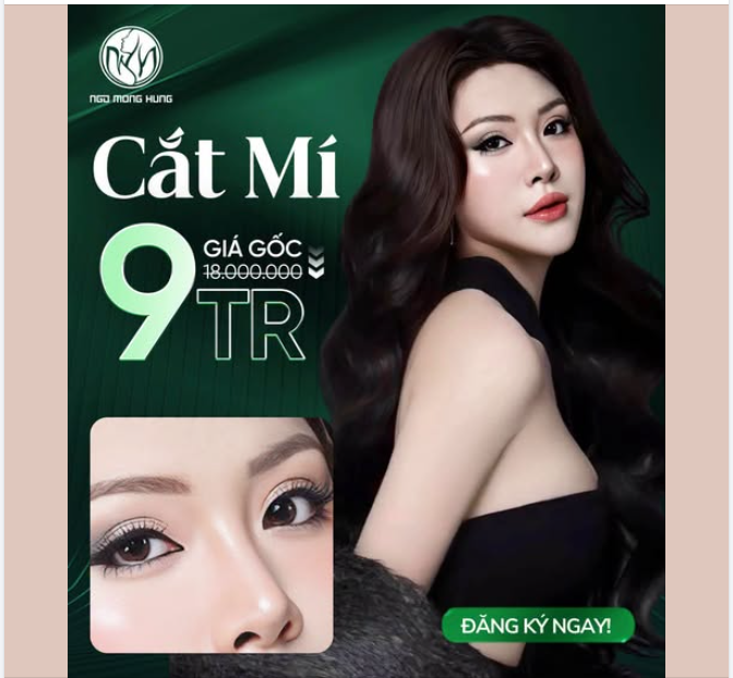 Một ánh nhìn cuốn hút, bắt đầu từ một nếp mí hài hòa!