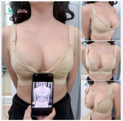“ĐỘ LOA” BAO LÂU THÌ ĐẸP? – Feedback sau 20 ngày sẽ cho các nàng câu trả lời!