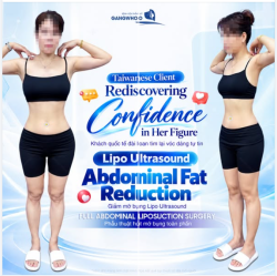 KHÁCH QUỐC TẾ ĐÀI LOAN TÌM LẠI VÓC DÁNG TỰ TIN GIẢM MỠ LIPO ULTRASOUND