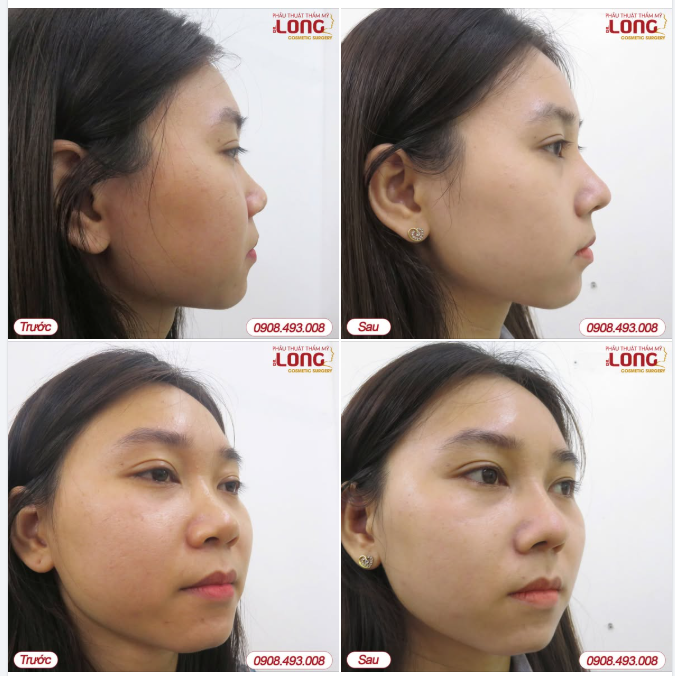 Quy Trình 3 Bước Để "Đúng Ngay Từ Đầu"
