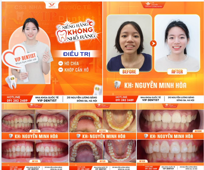 KHÔNG CẦN PHẪU THUẬT THẨM MỸ CŨNG THAY ĐỔI CẢ GƯƠNG MẶT!