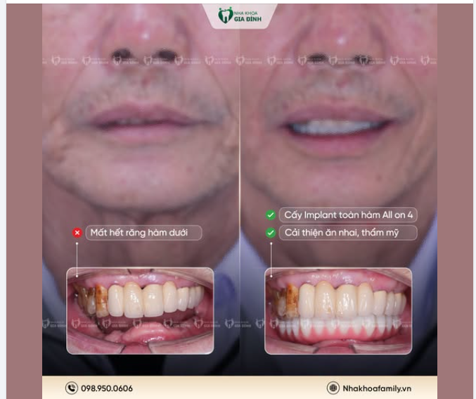 Mỗi nụ cười được hồi sinh là một câu chuyện đầy cảm xúc!