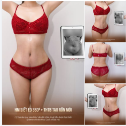 SIẾT EO 360° – KHI HÚT MỠ KHÔNG CHỈ LÀ LẤY ĐI MỠ THỪA