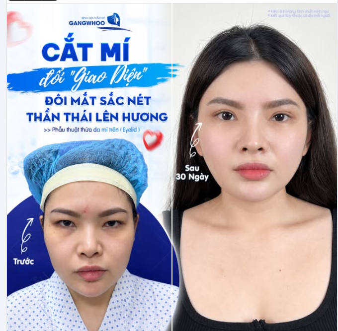 ĐỔI "GIAO DIỆN" SAU 30 NGÀY CẮT MÍ