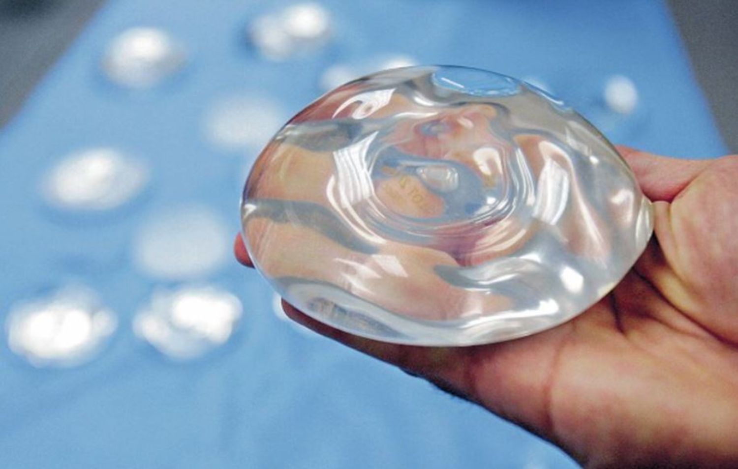 Sự trở lại của túi gel silicone trong nâng ngực - Thẩm mỹ Bauman Clinic
