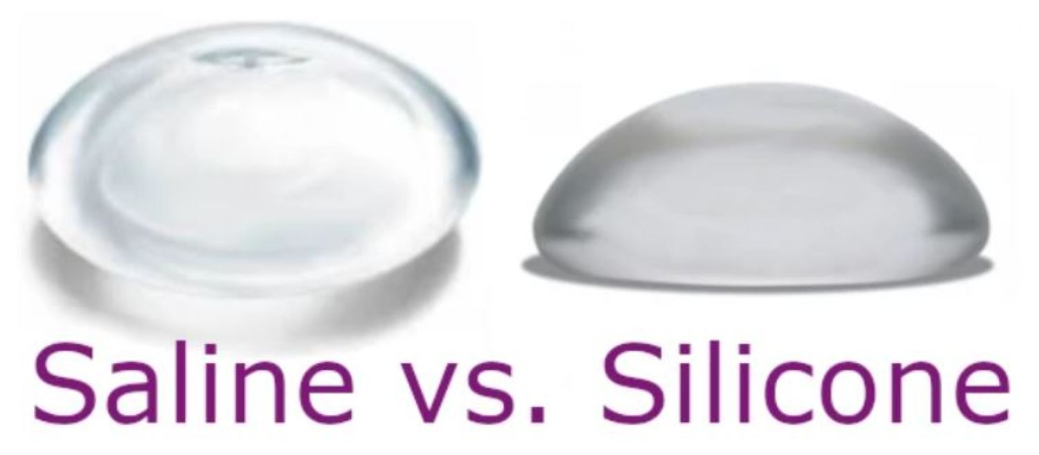 Túi gel silicone và túi nước muối - Thẩm mỹ Bauman Clinic