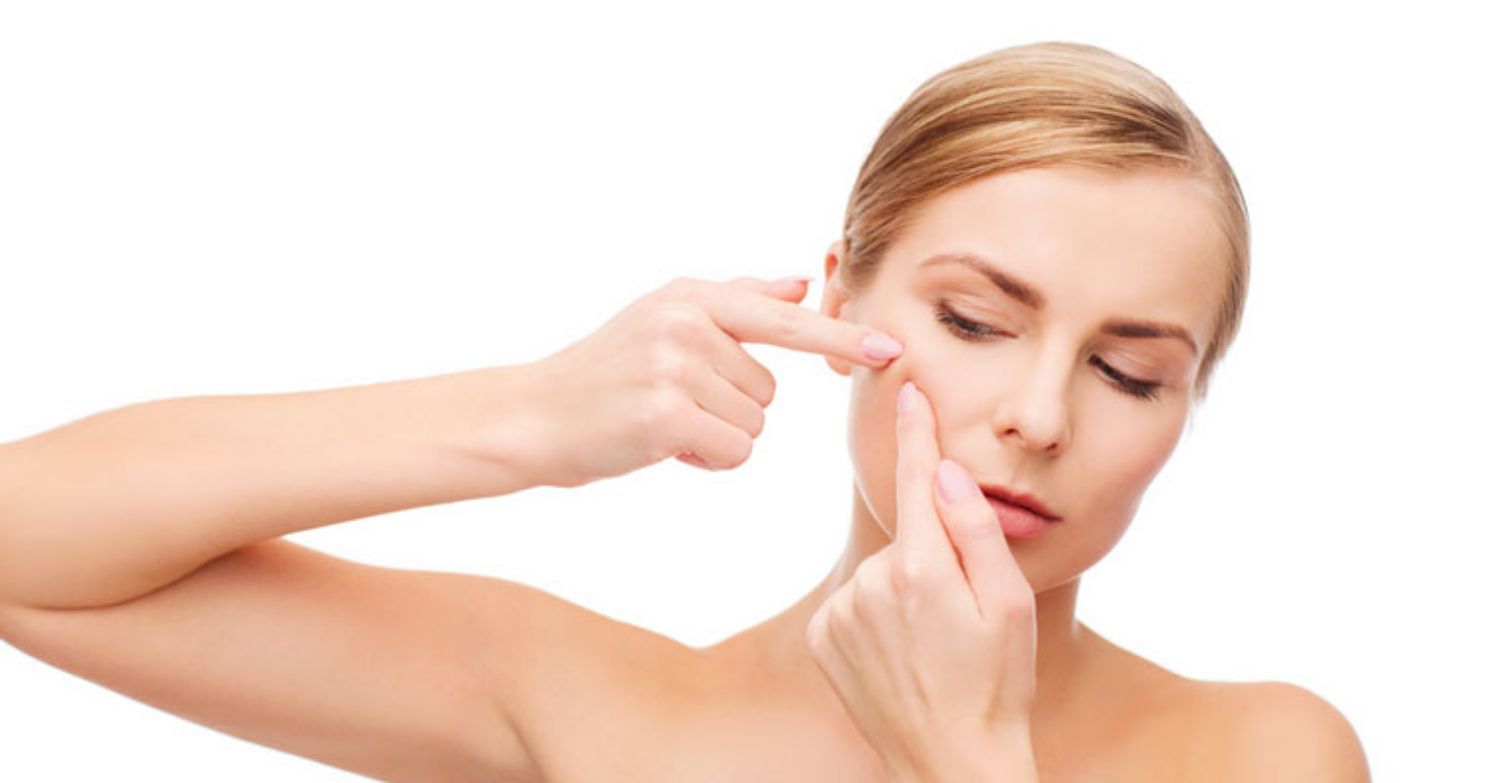 10 tip trị mụn cho vùng mặt