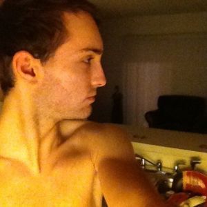 Phân biệt hói đầu và trán rộng (trán cao)